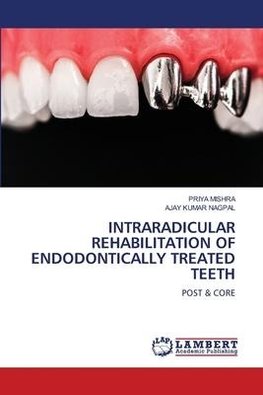 INTRARADICULAR REHABILITATION OF ENDODONTICALLY TREATED TEETH