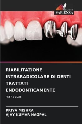 RIABILITAZIONE INTRARADICOLARE DI DENTI TRATTATI ENDODONTICAMENTE