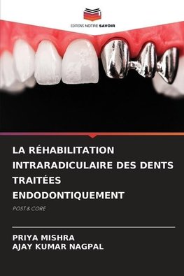 LA RÉHABILITATION INTRARADICULAIRE DES DENTS TRAITÉES ENDODONTIQUEMENT