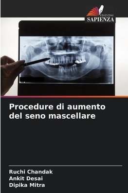 Procedure di aumento del seno mascellare