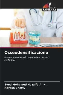 Osseodensificazione