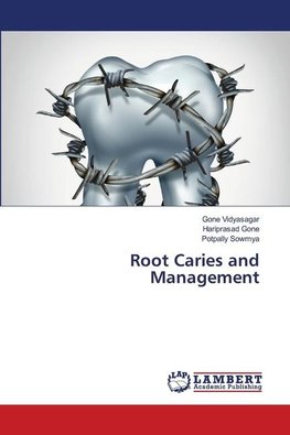 Root Caries and Management