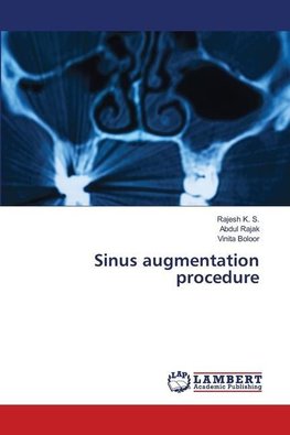 Sinus augmentation procedure