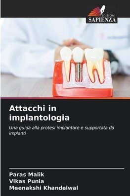 Attacchi in implantologia