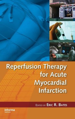 Reperfusion Therapy for Acute Myocardial Infarction