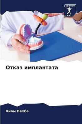 Otkaz implantata