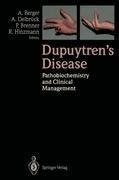 Dupuytren's Disease