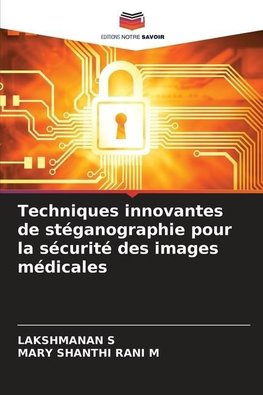 Techniques innovantes de stéganographie pour la sécurité des images médicales