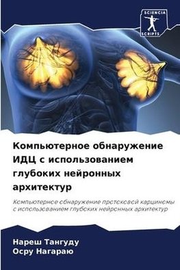 Komp'üternoe obnaruzhenie IDC s ispol'zowaniem glubokih nejronnyh arhitektur