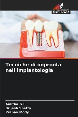 Tecniche di impronta nell'implantologia