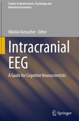 Intracranial EEG