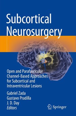 Subcortical Neurosurgery