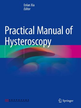 Practical Manual of Hysteroscopy