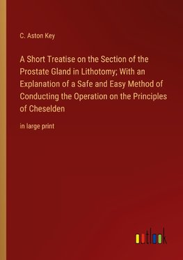 A Short Treatise on the Section of the Prostate Gland in Lithotomy; With an Explanation of a Safe and Easy Method of Conducting the Operation on the Principles of Cheselden