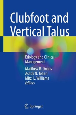 Clubfoot and Vertical Talus