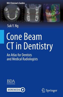 Cone Beam CT in Dentistry