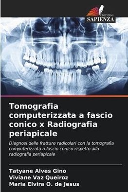 Tomografia computerizzata a fascio conico x Radiografia periapicale