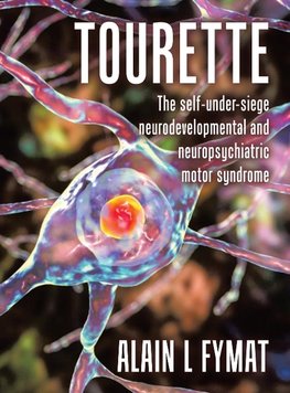 Tourette