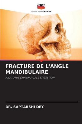 FRACTURE DE L'ANGLE MANDIBULAIRE