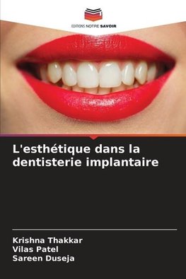 L'esthétique dans la dentisterie implantaire