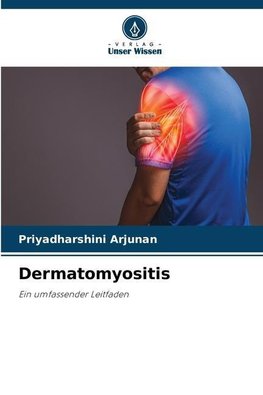 Dermatomyositis