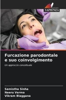 Furcazione parodontale e suo coinvolgimento