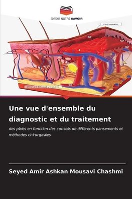 Une vue d'ensemble du diagnostic et du traitement