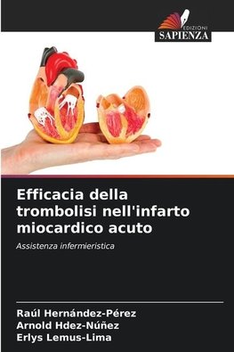 Efficacia della trombolisi nell'infarto miocardico acuto