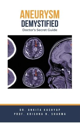 Aneurysm Demystified