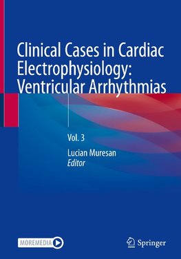 Clinical Cases in Cardiac Electrophysiology: Ventricular Arrhythmias