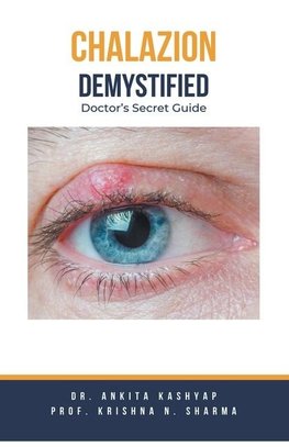 Chalazion Demystified