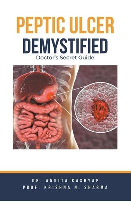 Peptic Ulcer Demystified