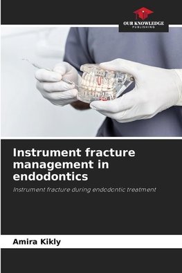 Instrument fracture management in endodontics