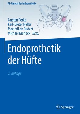 Endoprothetik der Hüfte