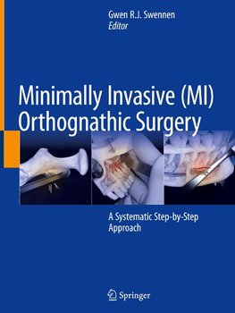 Minimally Invasive (MI) Orthognathic Surgery