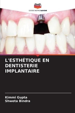 L'ESTHÉTIQUE EN DENTISTERIE IMPLANTAIRE