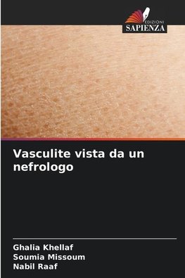 Vasculite vista da un nefrologo