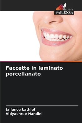 Faccette in laminato porcellanato