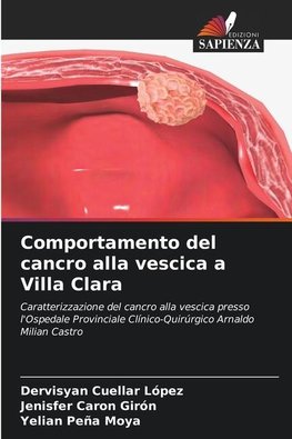 Comportamento del cancro alla vescica a Villa Clara