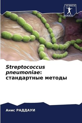 Streptococcus pneumoniae: standartnye metody