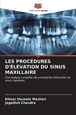 LES PROCÉDURES D'ÉLÉVATION DU SINUS MAXILLAIRE