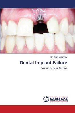 Dental Implant Failure