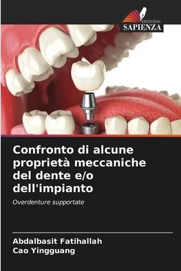 Confronto di alcune proprietà meccaniche del dente e/o dell'impianto