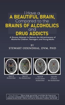 I Have a Beautiful Brain, Compared to the Brains of Alcoholics and Drug Addicts