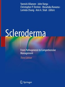 Scleroderma