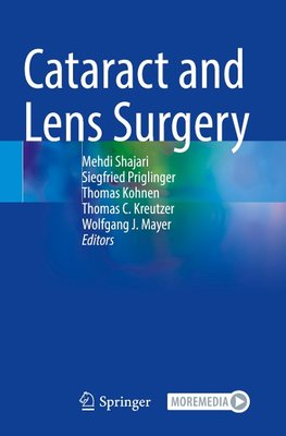 Cataract and Lens Surgery