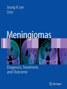 Meningiomas