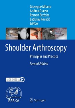 Shoulder Arthroscopy