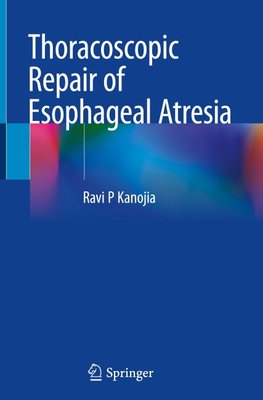 Thoracoscopic Repair of Esophageal Atresia