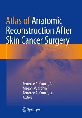 Atlas of Anatomic Reconstruction After Skin Cancer Surgery